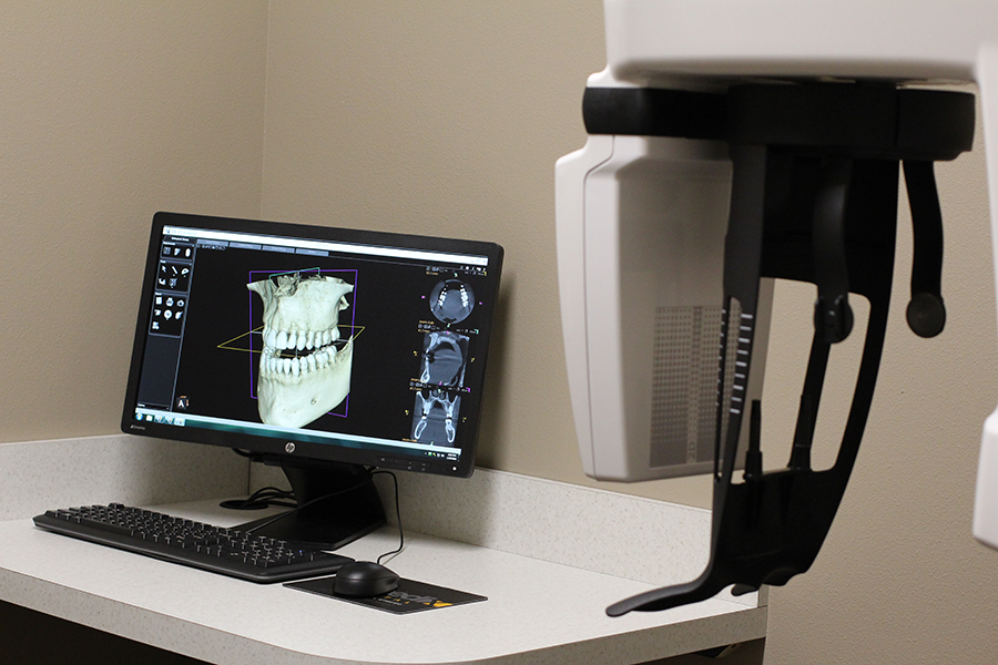 Eastern Iowa Endodontics Cone Beam Computed Tomography Computer
